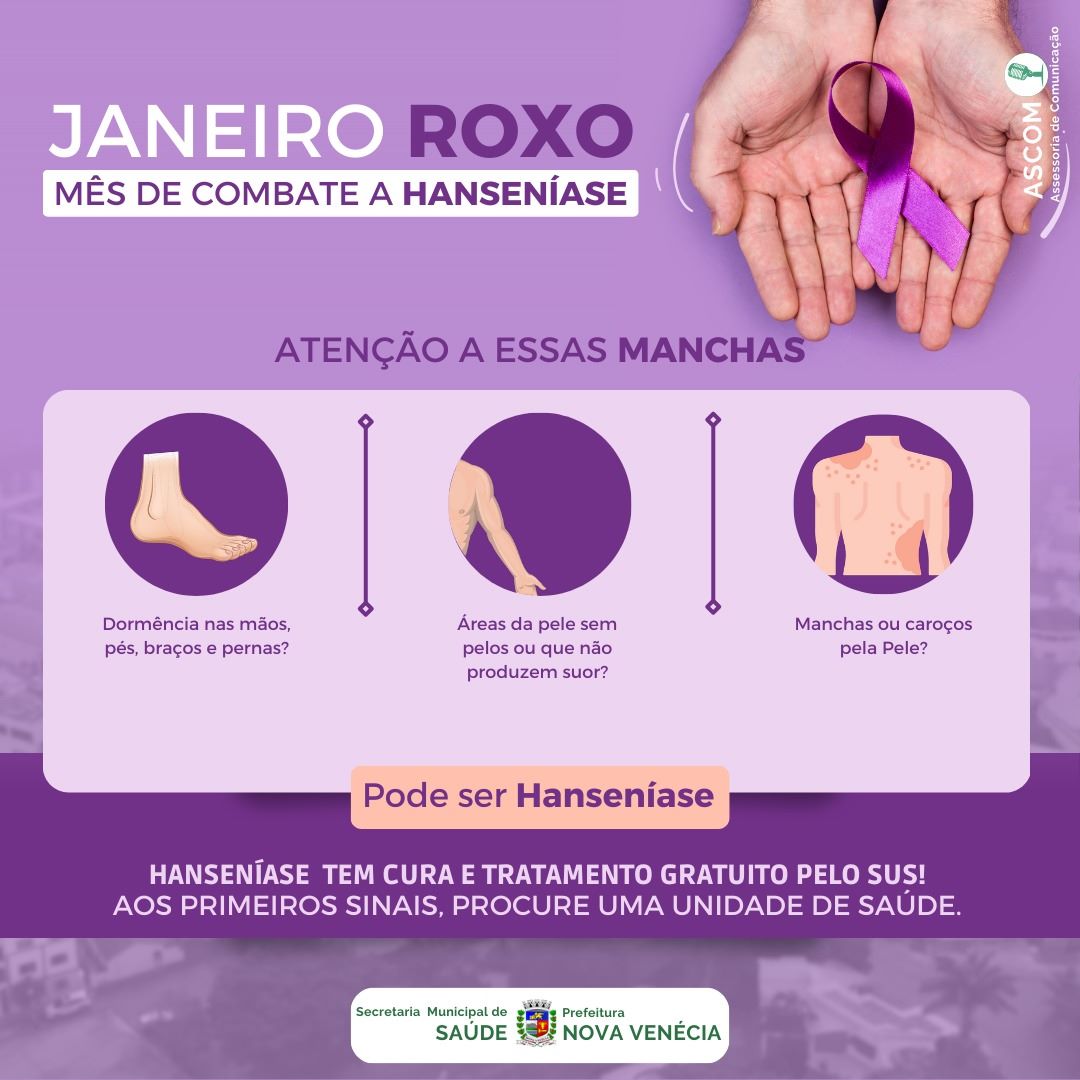 Janeiro Roxo marca o combate à hanseníase - Secretaria da Saúde
